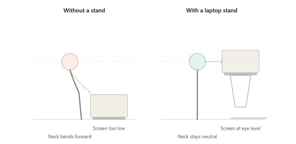 Why a Laptop Stand Matters More Than You Think
