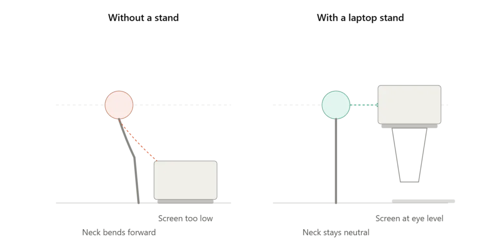 Why a Laptop Stand Matters More Than You Think